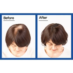 ヨドバシ.com - スーパーミリオンヘアー スーパーミリオンヘアー