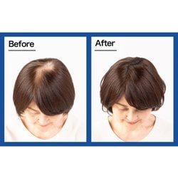 ヨドバシ.com - スーパーミリオンヘアー スーパーミリオンヘアー