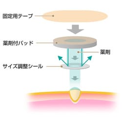 ☘️デコピン☘️　スピールフォーム　未使用　印有り　6点セット 楽天市場】プレミアム☆*スワロフスキーデコレーション