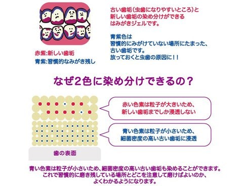 ヨドバシ.com - オカムラ はみがき先生 2色染めはみがきジェル [対象