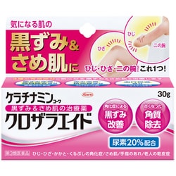 ケラチナミンコーワ クロザラエイド 30g [第3類医薬品 皮膚用治療薬]