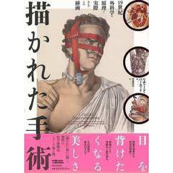 【バーゲンブック】描かれた手術-19世紀外科学の原理と実際およびその挿画 [単行本]