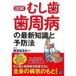【バーゲンブック】図解むし歯・歯周病の最新知識と予防法 [単行本]