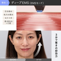 ヨドバシ.com - マイトレックス MYTREX 美顔器 MYTREX MiRAY ONE