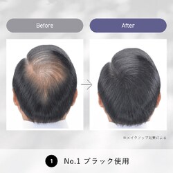 ヨドバシ.com - スーパーミリオンヘアー スーパーミリオンヘアー