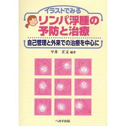 イラストでみるリンパ浮腫の予防と治療－自己管理と外来での治療を中心に [単行本]