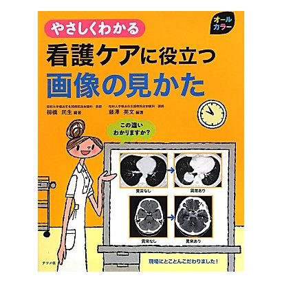 オールカラー やさしくわかる看護ケアに役立つ画像の見かた [事典辞典]