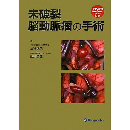 未破裂脳動脈瘤の手術 [単行本]