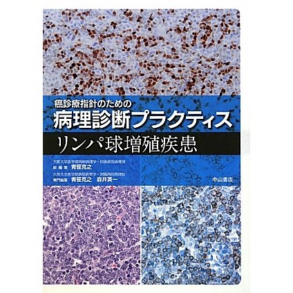 癌診療指針のための病理診断プラクティス リンパ球増殖疾患 [全集叢書]