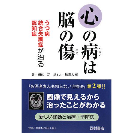 心の病は脳の傷―うつ病・統合失調症・認知症が治る [単行本]