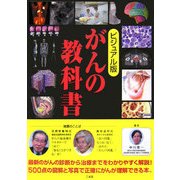 ビジュアル版 がんの教科書 [単行本]
