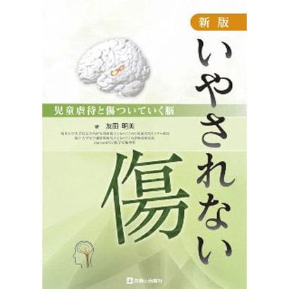 いやされない傷 新版－児童虐待と傷ついていく脳 [単行本]