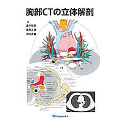 胸部CTの立体解剖 胸部CTの立体解剖 | 畠中 陸郎 |本 | 通販 | Amazon