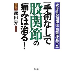 「手術なし」で股関節の痛みは治る!―変形性股関節症・臼蓋形成不全 [単行本]