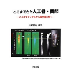 ここまできた人工骨・関節―バイオマテリアルから再生医工学へ [単行本]