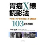 胃癌X線読影法－ネガ像、ポジ像の対比による難読影103の症例の解析 [単行本]