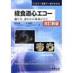 経食道心エコー 第2版－カラー写真で一目でわかる 撮り方、診かたの基本とコツ [単行本]