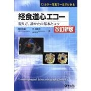 経食道心エコー 第2版－カラー写真で一目でわかる 撮り方、診かたの基本とコツ [単行本]