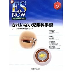 きれいな小児眼科手術―これであなたも悩まない!(新ES NOW〈No.6〉) [全集叢書]
