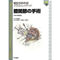 ヨドバシ Com 膝関節の手術 整形外科手術イラストレイテッド 全集叢書 通販 全品無料配達