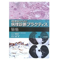 癌診療指針のための病理診断プラクティス 肺癌 ヨドバシ.com - 癌診療指針のための病理診断プラクティス 肺癌