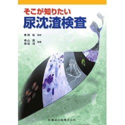 そこが知りたい尿沈渣検査 [単行本]