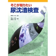 そこが知りたい尿沈渣検査 [単行本]