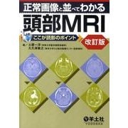 正常画像と並べてわかる頭部MRI 改訂版－ここが読影のポイント [単行本]