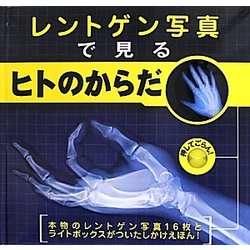 レントゲン写真で見るヒトのからだ(しかけえほん) [絵本]