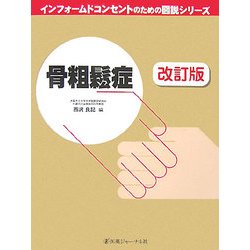 骨粗鬆症 改訂版 (インフォームドコンセントのための図説シリーズ) [単行本]