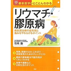 リウマチ・膠原病―病気別治療の最先端と痛みをやわらげるポイント(最新医学がとことんわかる) [単行本]