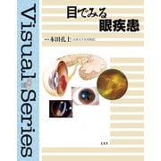 目でみる眼疾患 [単行本]