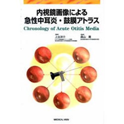 内視鏡画像による急性中耳炎・鼓膜アトラス ヨドバシ.com - 内視鏡画像による急性中耳炎・鼓膜アトラス