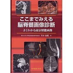 ヨドバシ.com - ここまでみえる脳脊髄画像診断 [単行本] 通販【全品無料配達】