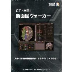 ヨドバシ.com - CT・MRI断面図ウォーカー[CD-ROM] 通販【全品無料配達】