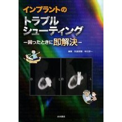 インプラントのトラブルシューティング－困ったときに即解決 [単行本]