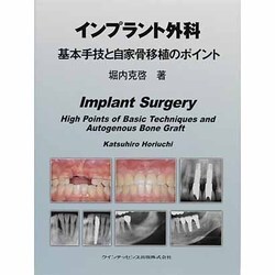 ヨドバシ.com - インプラント外科基本手技と自家骨移植のポイント 