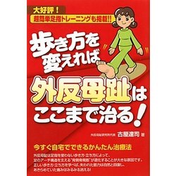 歩き方を変えれば外反母趾はここまで治る! [単行本]