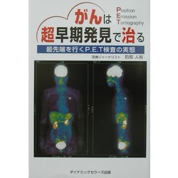 がんは超早期発見で治る―最先端を行くP.E.T検査の実態 [単行本]