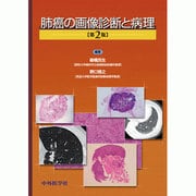 肺癌の画像診断と病理 2版 [単行本]
