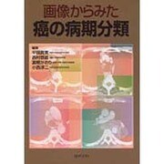 画像からみた癌の病期分類 [単行本]