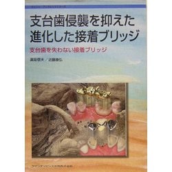 支台歯侵襲を抑えた進化した接着ブリッジ―支台歯を失わない接着ブリッジ [単行本]