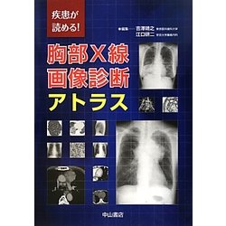ヨドバシ.com - 疾患が読める!胸部X線画像診断アトラス [単行本] 通販 