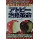 もみほぐせば治る! アトピー治療革命 [単行本]