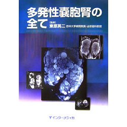 多発性嚢胞腎の全て