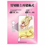 胃切除と再建術式 [単行本]