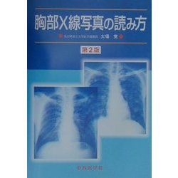 ゼッタイわかる胸部Ｘ線写真の読み方 改訂第２版/医学教育出版社/医師国試対策編集委員会（単行本） ゼッタイわかる胸部X線写真の読み方 改訂第2版/医学教育出版社/