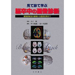 見て診て学ぶ脳卒中の画像診断―画像診断法の基礎から臨床応用まで [単行本]