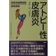 アトピー性皮膚炎―最新・賢い患者学(聖路加国際病院健康講座〈9〉) [単行本]