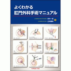 よくわかる肛門外科手術マニュアル [単行本]